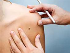 Checking-mole-shoulder-feature.jpg
