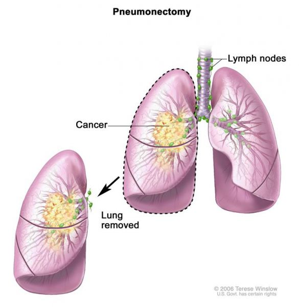 File:CDR466556-750.jpg