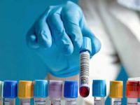 Hand-drawing-blood-sample-tube-article.jpg