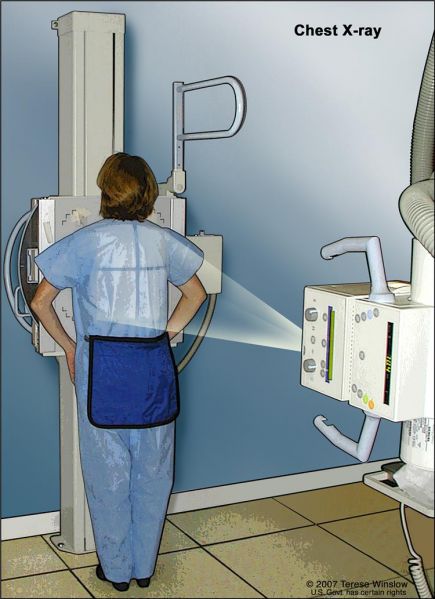 File:CDR428438-750.jpg