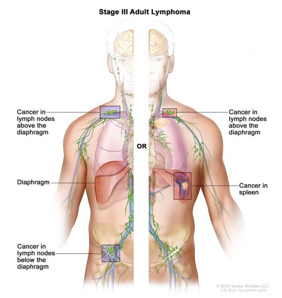File:CDR614684-750.jpg