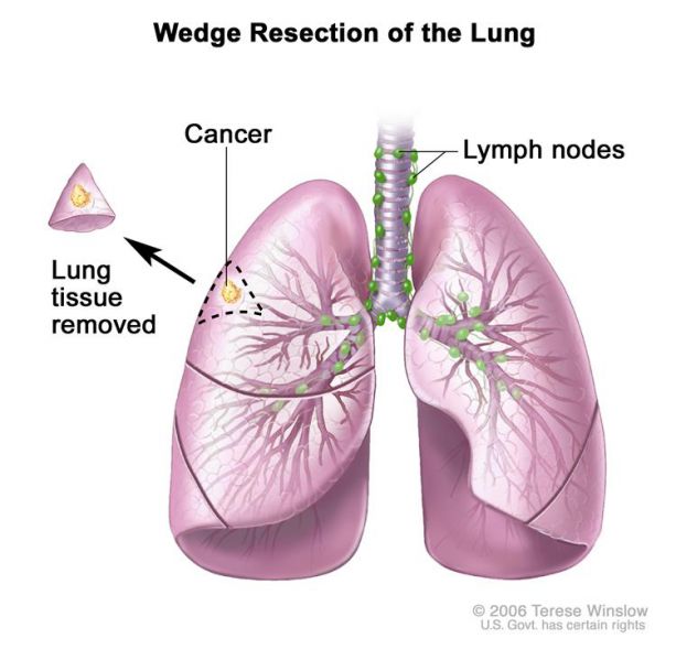 File:CDR466555-750.jpg
