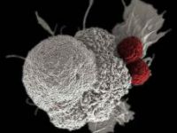 Oral-squamous-cancer-cell-article.jpg