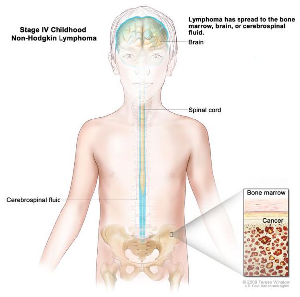 File:CDR614642-750.jpg