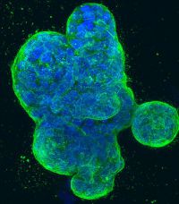 Breast-cancer-cells-article.jpg