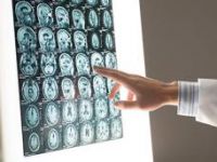 Examining-brain-scans-article.jpg